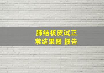 肺结核皮试正常结果图 报告